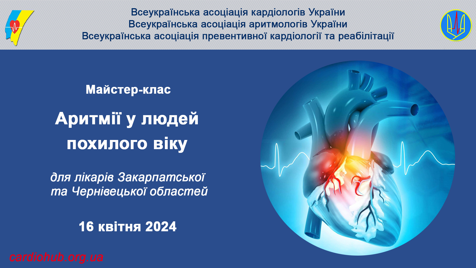 16.04.2024 : Майстер-клас: “Аритмії у людей похилого віку” для лікарів Закарпатської та Чернівецької областей
