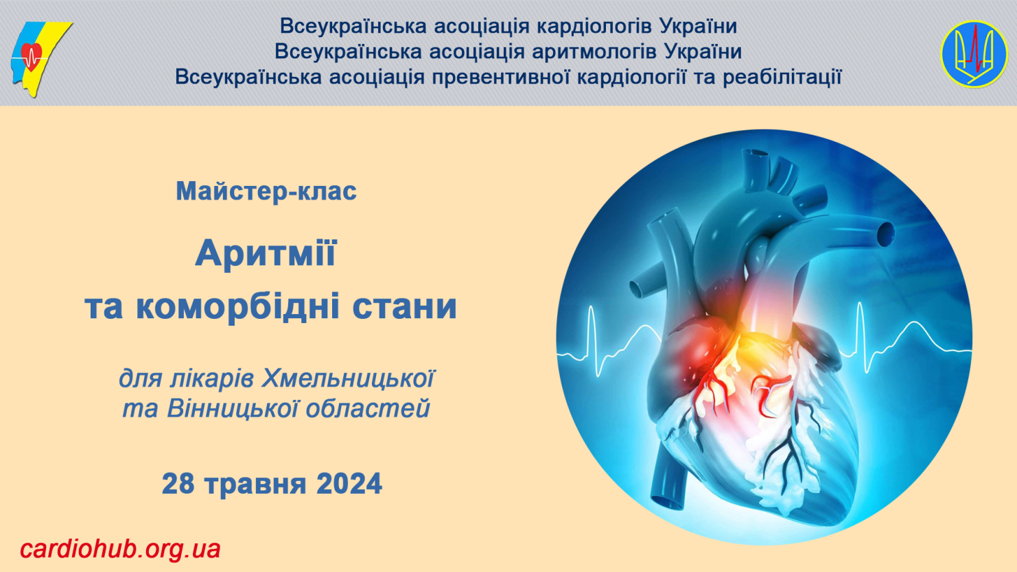 28.05.2024 : Майстер-клас: “Аритмії та коморбідні стани” для лікарів Хмельницької та Вінницької областей