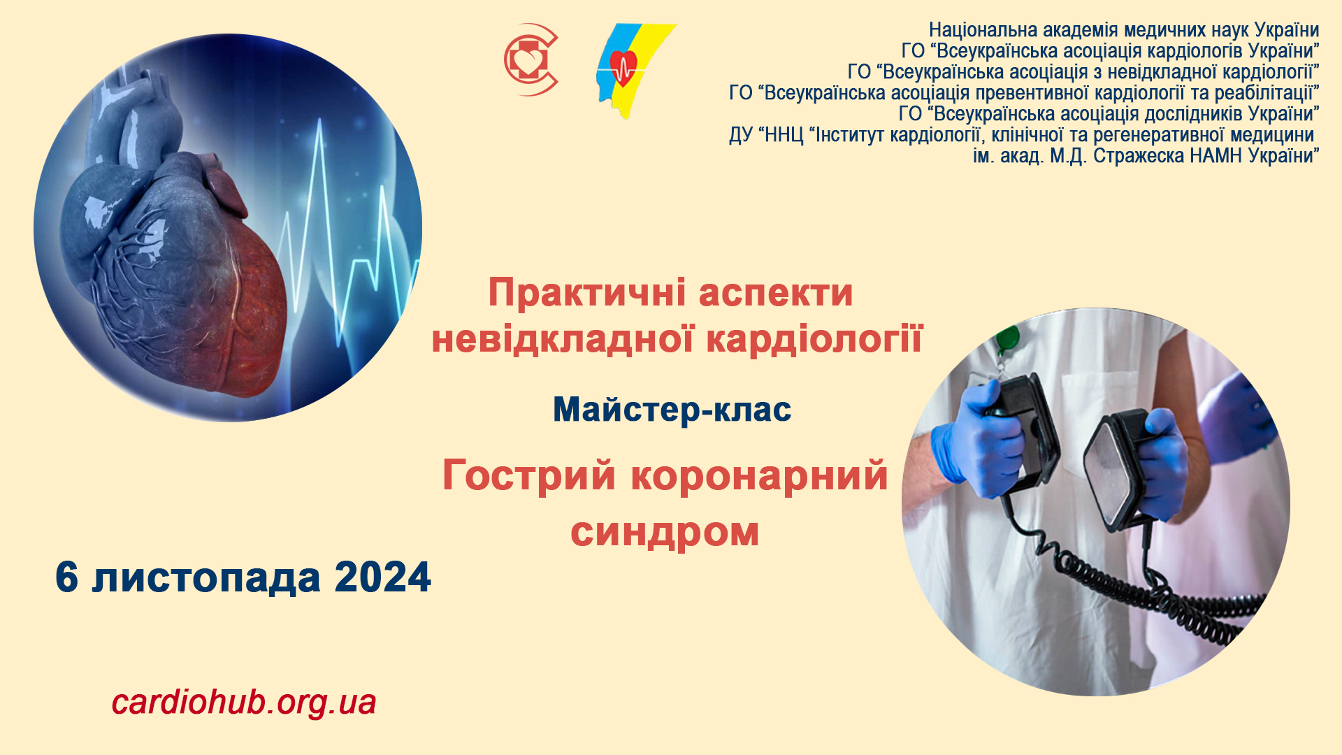 6.11.2024 : Майстер-клас:  Практичні аспекти невідкладної кардіології:  Гострий коронарний синдром