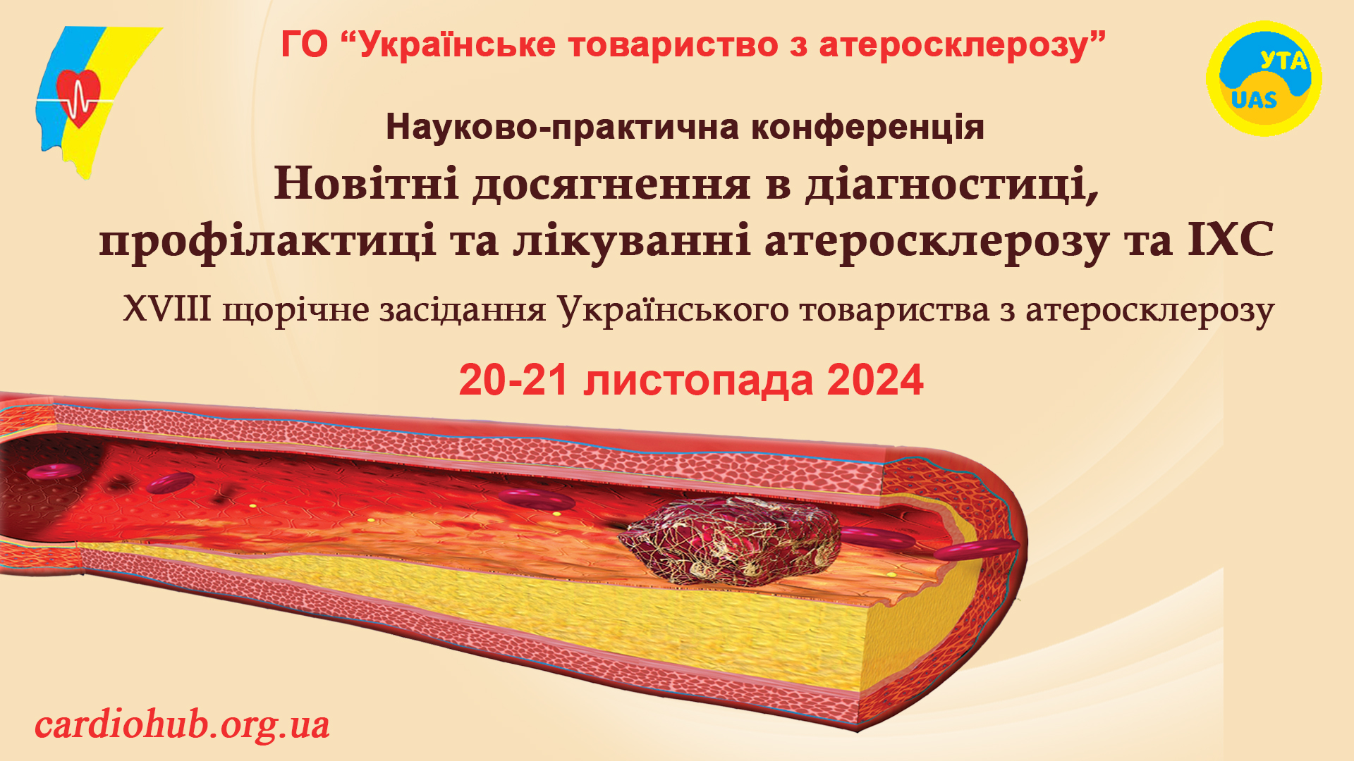 20.11.2024 : Науково-практичної конференції: Новітні досягнення в діагностиці, профілактиці та лікуванні атеросклерозу та ІХС