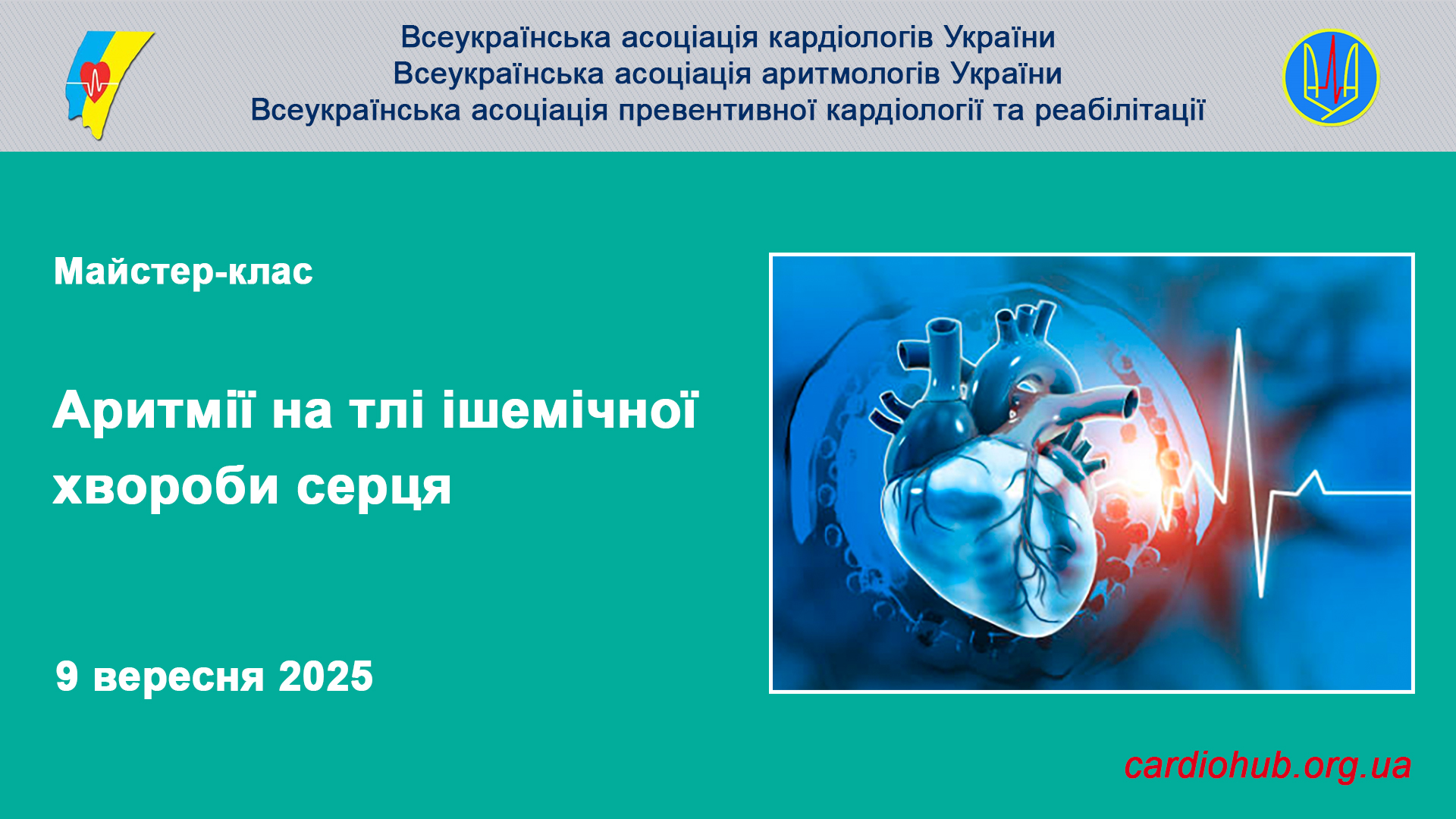 09.09.2025: Майстер-клас: «Аритмії на тлі ішемічної хвороби серця»
