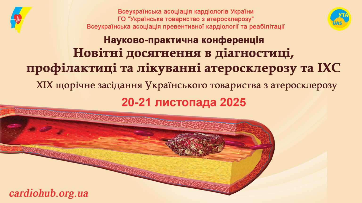 20-21.11.2025: Науково-практична конференція: «Новітні досягнення в діагностиці, профілактиці та лікуванні атеросклерозу та ІХС»