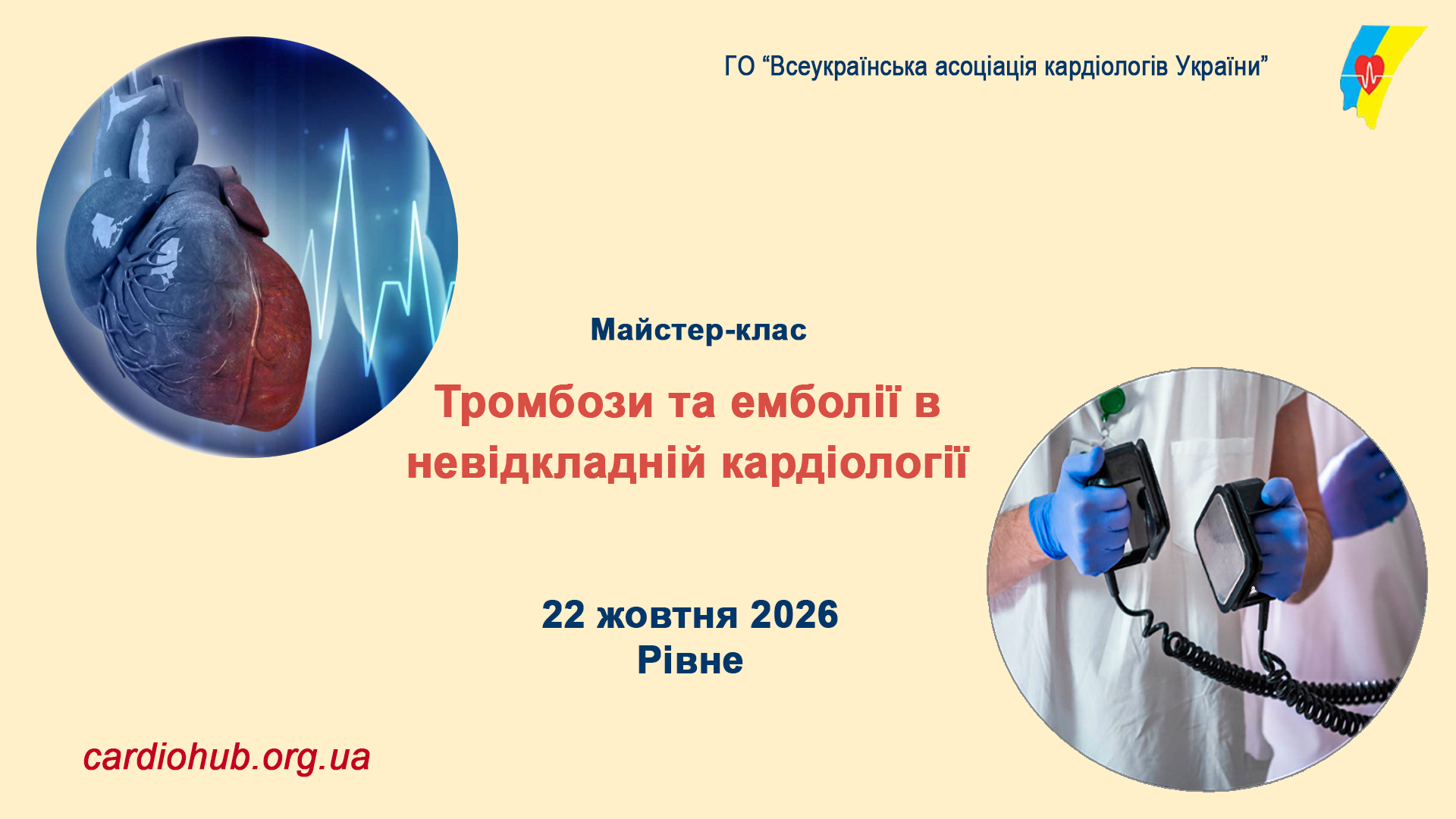 Майстер-клас: Тромбози та емболії в невідкладній кардіології